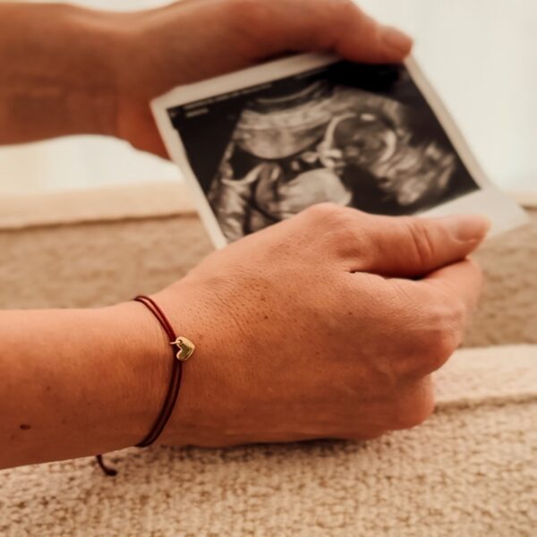 Koesterjuweel 'Stilgeboorte'